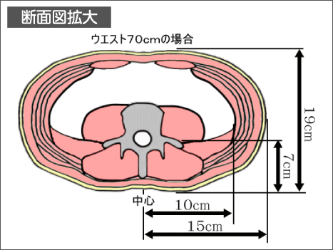 腰痛は腰痛アカデミーで、ヘルニア、狭窄症も治る、更に坐骨神経痛も治す坂戸孝志の名医による腰痛は自分で治せる治療法