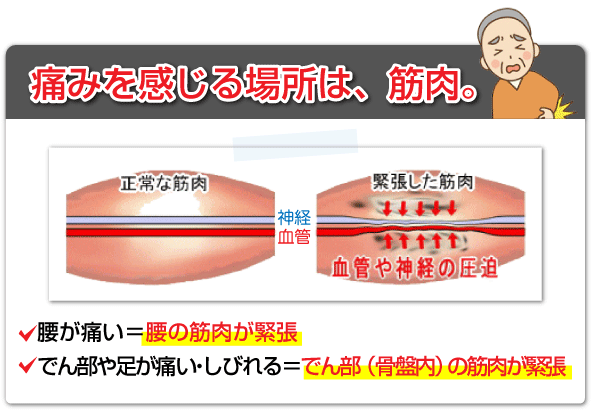 腰痛を治す腰痛アカデミーで坂戸孝志先生が解説しております
腰痛、ヘルニア、狭窄症、坐骨神経痛、の痛みを感じる神経のある場所は、筋肉です。
