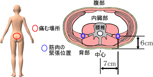 腰痛を治す腰痛アカデミーは腰痛やヘルニア、狭窄症、坐骨神経痛を治すため坂戸孝志先生により考案された自分で治せる治療法