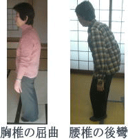 腰痛を腰痛アカデミーで痛みを消す、ヘルニア、狭窄症、坐骨神経痛等の痛みを改善させるための名医坂戸孝志のサポートを受けられた胸椎の屈折・腰椎の後攣。
